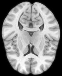 MRI / MRT volume slice