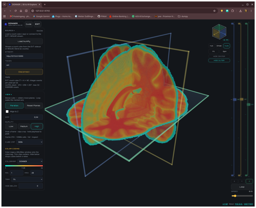 DONNER exploring a volumetric brain scan